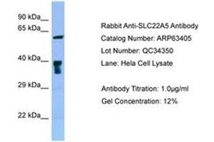 Image no. 1 for anti-Solute Carrier Family 22 Member 5 (SLC22A5) (C-Term) antibody (ABIN6749981) (SLC22A5 抗体  (C-Term))