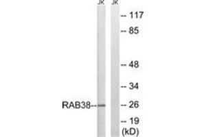 Western blot analysis of extracts from Jurkat cells, using RAB38 Antibody. (RAB38 抗体  (AA 80-129))