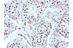 Immunohistochemistry (IHC) image for anti-Histone H1 antibody (ABIN6939594)