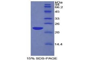 SDS-PAGE analysis of Rat LEDGF Protein. (PSIP1 蛋白)