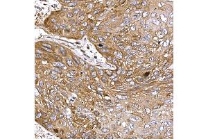 Immunohistochemistry (IHC) image for anti-Dynein, Cytoplasmic 1, Light Intermediate Chain 2 (DYNC1LI2) antibody (ABIN7266863)