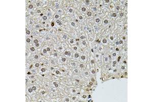 Immunohistochemistry of paraffin-embedded mouse liver using PNKP antibody (ABIN5974039) at dilution of 1/100 (40x lens).