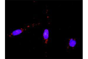 Proximity Ligation Analysis of protein-protein interactions between RAD51 and CASP3. (RAD51 抗体  (AA 1-339))