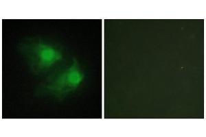 Immunofluorescence (IF) image for anti-LIM Domain Kinase 2 (LIMK2) (Internal Region) antibody (ABIN1849456) (LIMK2 抗体  (Internal Region))