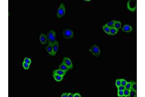 Immunofluorescent analysis of HepG2 cells using ABIN7162265 at dilution of 1:100 and Alexa Fluor 488-congugated AffiniPure Goat Anti-Rabbit IgG(H+L) (SLC51B 抗体  (AA 57-128))