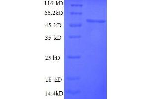 Ribosomal Protein L15 (RPL15) (AA 2-204), (full length) protein (GST tag) (RPL15 Protein (AA 2-204, full length) (GST tag))