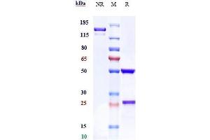 Anti-FcgR2a / CD32a Reference Antibody (VIB9600) on SDS-PAGE under reducing (R) condition.