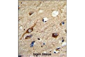Formalin-fixed and raffin-embedded human brain tissue reacted with AGT3 Antibody (Center), which was peroxidase-conjugated to the secondary antibody, followed by DAB staining. (AGPAT3 抗体  (AA 241-269))