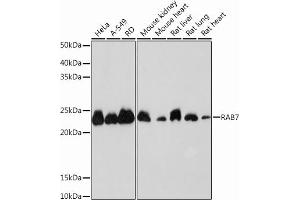 Western blot analysis of extracts of various cell lines, using R Rabbit mAb (ABIN7269812) at 1:1000 dilution. (RAB7A 抗体)
