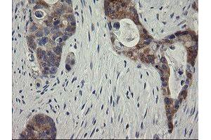 Image no. 2 for anti-RIO Kinase 2 (RIOK2) (AA 277-552) antibody (ABIN1491304) (RIOK2 抗体  (AA 277-552))