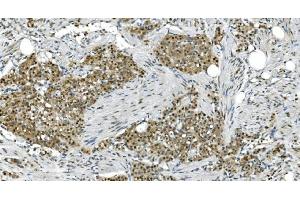 IHC analysis of LSM7 using anti-LSM7 antibody (ABIN7598937). (LSM7 抗体  (AA 1-103))