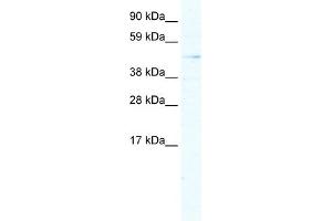 WB Suggested Anti-ARX Antibody Titration:  5. (Arx 抗体  (Middle Region))