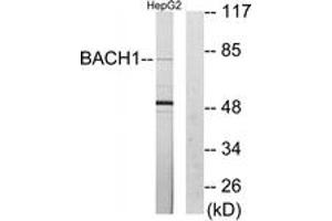 Western blot analysis of extracts from HepG2 cells, using BACH1 Antibody. (BACH1 抗体  (AA 131-180))