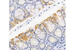 Immunohistochemistry analysis of paraffin-embedded rat colon using,RARS (ABIN7073119) at dilution of 1: 1800 (RARS 抗体)