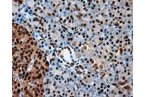 Immunohistochemical staining of paraffin-embedded colon tissue using anti-LTA4H mouse monoclonal antibody. (LTA4H 抗体)