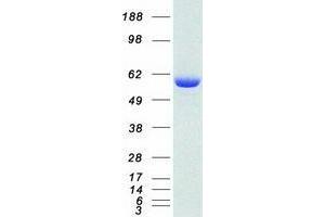 Western Blotting (WB) image for Ubiquitin Specific Peptidase 14 (USP14) (Transcript Variant 1) protein (Myc-DYKDDDDK Tag) (ABIN2735094)