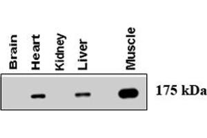 Western blot using AGL polyclonal antibody  at 1 : 500 dilution . (AGL 抗体  (AA 1479-1510))