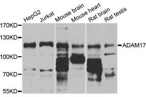 Western Blotting (WB) image for anti-ADAM Metallopeptidase Domain 17 (ADAM17) (C-Term) antibody (ABIN5663782) (ADAM17 抗体  (C-Term))