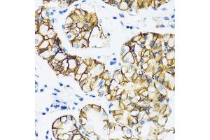 Immunohistochemistry of paraffin-embedded human stomach using CTNNA1 antibody. (CTNNA1 抗体  (AA 637-906))