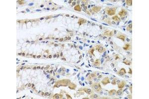 Immunohistochemistry of paraffin-embedded Human stomach using TRMT1 Polyclonal Antibody at dilution of 1:100 (40x lens).