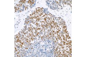 Immunohistochemistry (IHC) image for anti-SWI/SNF Related, Matrix Associated, Actin Dependent Regulator of Chromatin, Subfamily A, Member 4 (SMARCA4) (AA 75-125) antibody (ABIN7453997)