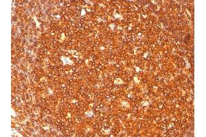 Formalin-fixed, paraffin-embedded human Tonsil stained with HLA-DR Monoclonal Antibody (SPM289). (HLA-DR 抗体)