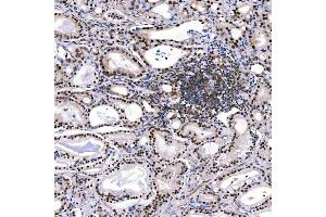 IHC analysis of SMARCA2/BRM using anti-SMARCA2/BRM antibody (ABIN7601969).