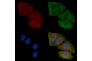 ABIN6262072 and ABIN6266555 staining Hela cells(45 min of heat-shock) by IF/ICC.
