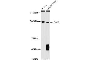 Western blot analysis of extracts of various cell lines, using LOXL2 antibody (ABIN7268349) at 1:500 dilution. (LOXL2 抗体  (AA 505-774))