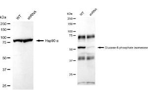 Western blotting analysis using Glucose 6 phosphate isomerase antibody (ABIN7798734). (Recombinant GPI 抗体)