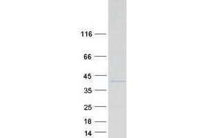 Western Blotting (WB) image for Aldo-Keto Reductase Family 1, Member E2 (AKR1E2) protein (Myc-DYKDDDDK Tag) (ABIN2714508)