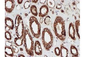 Immunohistochemical staining of paraffin-embedded Human Kidney tissue using anti-SCFD1 mouse monoclonal antibody. (SCFD1 抗体)