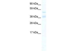 Western Blotting (WB) image for anti-Zinc Finger Protein 17 (ZNF17) antibody (ABIN2461332) (ZNF17 抗体)