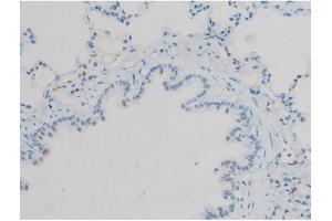 ABIN6267410 at 1/200 staining Rat lung tissue sections by IHC-P. (Connexin 43/GJA1 抗体  (pSer368))
