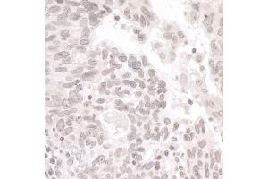 Immunohistochemistry (IHC) image for anti-Partner and Localizer of BRCA2 (PALB2) (AA 675-725) antibody (ABIN7454733) (PALB2 抗体  (AA 675-725))