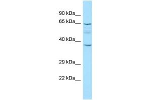 WB Suggested Anti-KRT77 Antibody Titration: 1. (Keratin 77 抗体  (C-Term))