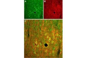 Immunohistochemistry (IHC) image for anti-Glutamate Receptor, Ionotropic, N-Methyl D-Aspartate 2B (GRIN2B) (Extracellular) antibody (ABIN7043230)