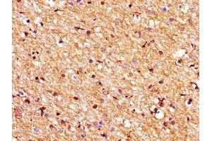 IHC image of ABIN7175545 diluted at 1:200 and staining in paraffin-embedded human brain tissue performed on a Leica BondTM system. (PROS1 抗体  (AA 42-676))