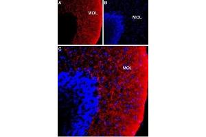 Immunohistochemistry (IHC) image for anti-Solute Carrier Family 12 (Potassium-Chloride Transporter) Member 2 (SLC12A2) (AA 828-841), (Intracellular) antibody (ABIN7043671)