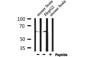 Western blot analysis of extracts from mouse brain and HepG2, using STIP1  Antibody. (STIP1 抗体  (N-Term))