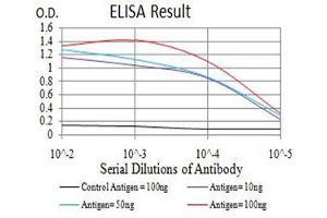 Black line: Control Antigen (100 ng),Purple line: Antigen (10 ng), Blue line: Antigen (50 ng), Red line:Antigen (100 ng) (BCAT2 抗体  (AA 259-393))