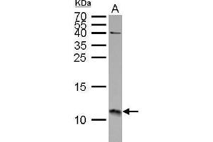 WB Image S100A11 antibody detects S100A11 protein by Western blot analysis. (S100A11 抗体)