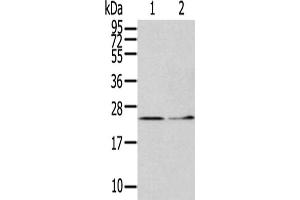 Gel: 12 % SDS-PAGE,Lysate: 40 μg,Lane 1-2: Hela cells, Human fetal liver tissue,Primary antibody: ABIN7127970(ITPA Antibody) at dilution 1/400 dilution,Secondary antibody: Goat anti rabbit IgG at 1/8000 dilution,Exposure time: 5 minutes (ITPA 抗体)