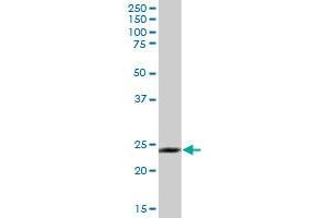 GOSR2 MaxPab polyclonal antibody. (GOSR2 抗体  (AA 1-213))