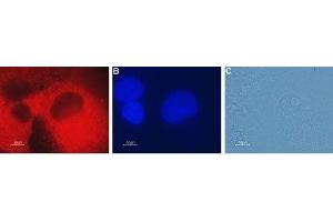 Expression of CLIC4 in human pancreatic carcinoma PANC-1 cells - Immunocytochemical staining of fixed and permeabilized human pancreatic carcinoma PANC-1 cells. (CLIC4 抗体  (Intracellular))