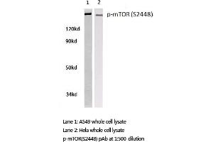 Western blot (WB) analysis of p-mTOR antibody in extracts from A549 and Hela cells. (MTOR 抗体  (pSer2448))