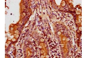 IHC image of ABIN7143136 diluted at 1:500 and staining in paraffin-embedded human small intestine tissue performed on a Leica BondTM system. (beta Actin 抗体  (AA 102-375))