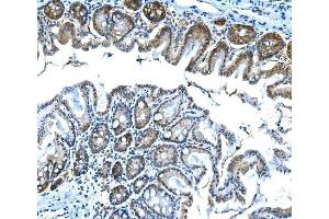 IHC analysis of Btc using anti-Btc antibody (ABIN7601294). (Betacellulin 抗体  (AA 32-111))