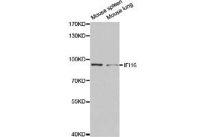 Western blot analysis of extracts of various cell lines, using IFI16 antibody (ABIN5971048) at 1/1000 dilution. (IFI16 抗体)