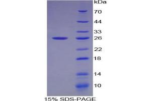 SDS-PAGE analysis of Cow Smad1 Protein. (SMAD1 蛋白)